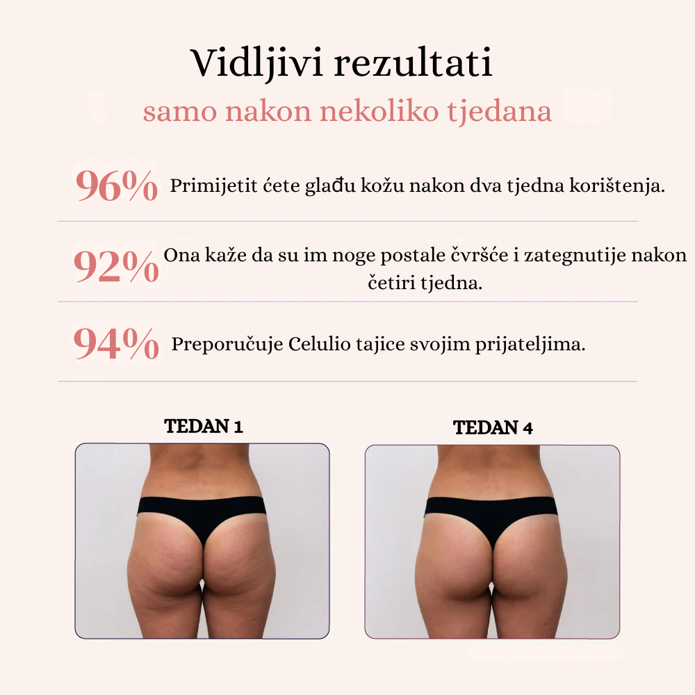 Modelirajuće tajice – Promijenite svoju figuru bez napora